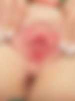 sex s fimozou