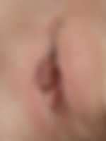 sex u zubaře
