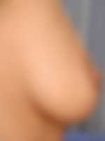privat prirodni klin